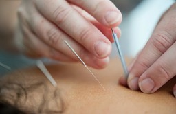 Close up of hands performing acupuncture